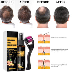 Kit de traitement avancé pour la croissance des cheveux 30 ml 2 pièces Spray pour la croissance des cheveux Rouleau de croissance des cheveux et ensemble d'essences Sérum pour la croissance des cheveux Anti-chute Sérum avancé pour la croissance des cheveux Soins capillaires Naty Shop