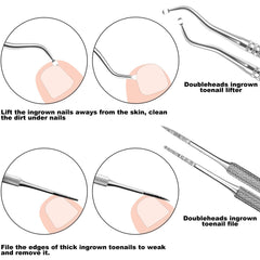 7-Teiliges Set Mit Filen Und Hebern Für Die Unternagelpflege, Set Aus Edelstahl Zum Entfernen Eingewachsener Zehennägel, Nagelreiniger Für Die Unternagelpflege, Pediküre-Werkzeuge