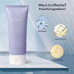 Crème anti-acné, 100 ml Cosmétiques et Beauté Naty Shop