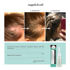 Ampoules de revitalisant capillaire Nuggela & Sulé, augmente la densité et la force des cheveux Soin capillaire Nuggela