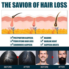 Sérum de croissance des cheveux Miioto, produit de croissance des cheveux pour hommes 180ML, sérum de croissance des cheveux, soin du cuir chevelu favorise les cheveux plus épais nourrit le cuir chevelu et prévient la chute des cheveux Naty Shop