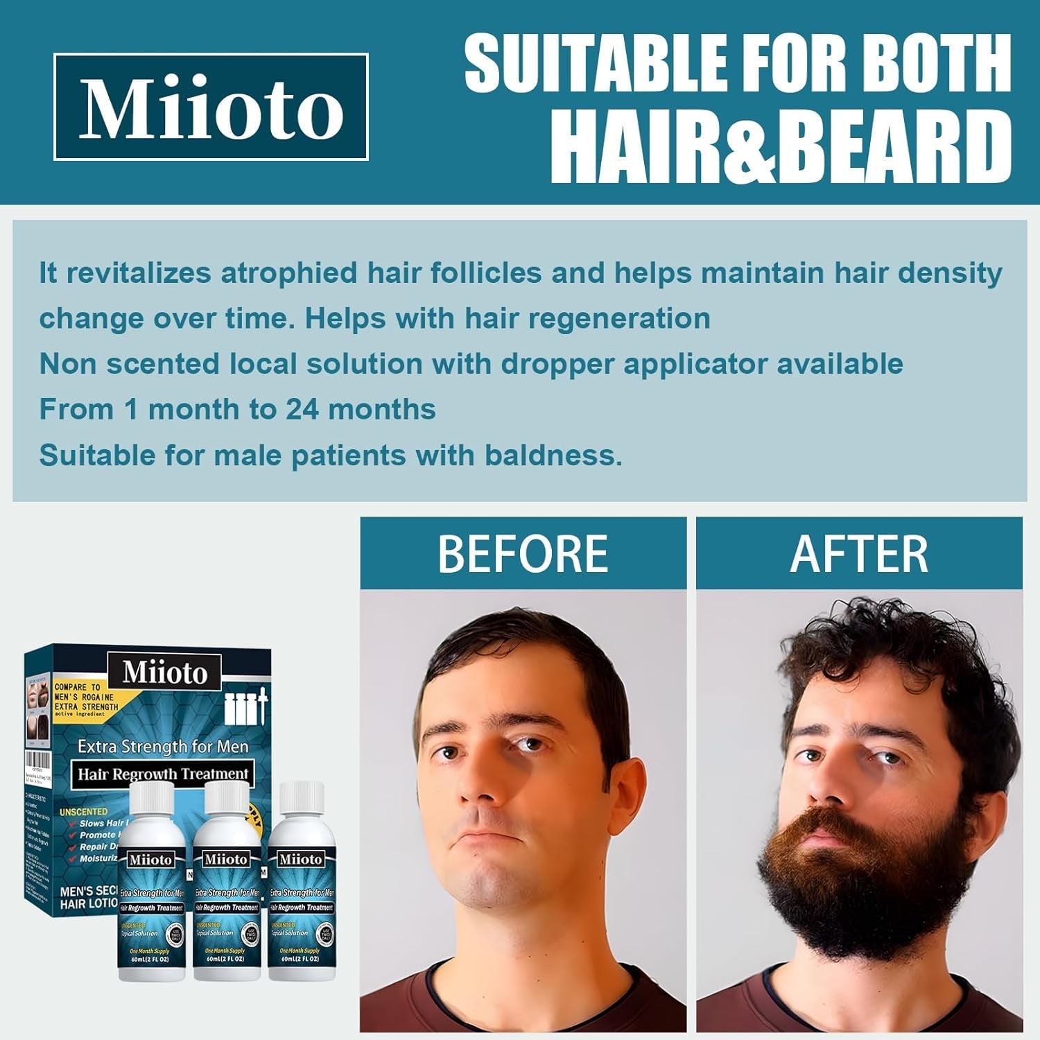 Sérum de croissance des cheveux Miioto, produit de croissance des cheveux pour hommes 180ML, sérum de croissance des cheveux, soin du cuir chevelu favorise les cheveux plus épais nourrit le cuir chevelu et prévient la chute des cheveux Naty Shop