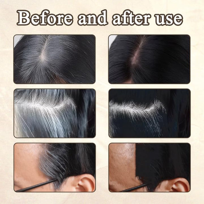 2pcs Poudre de Délié Brun Foncé, Poudre de Délié, Correcteur de Délié, Crayons de Couleur de Cheveux avec Peigne, Outil de Couvre-Cheveux Gris pour Femmes et Hommes (40g, Brun Foncé) Naty Shop Teinture pour Cheveux