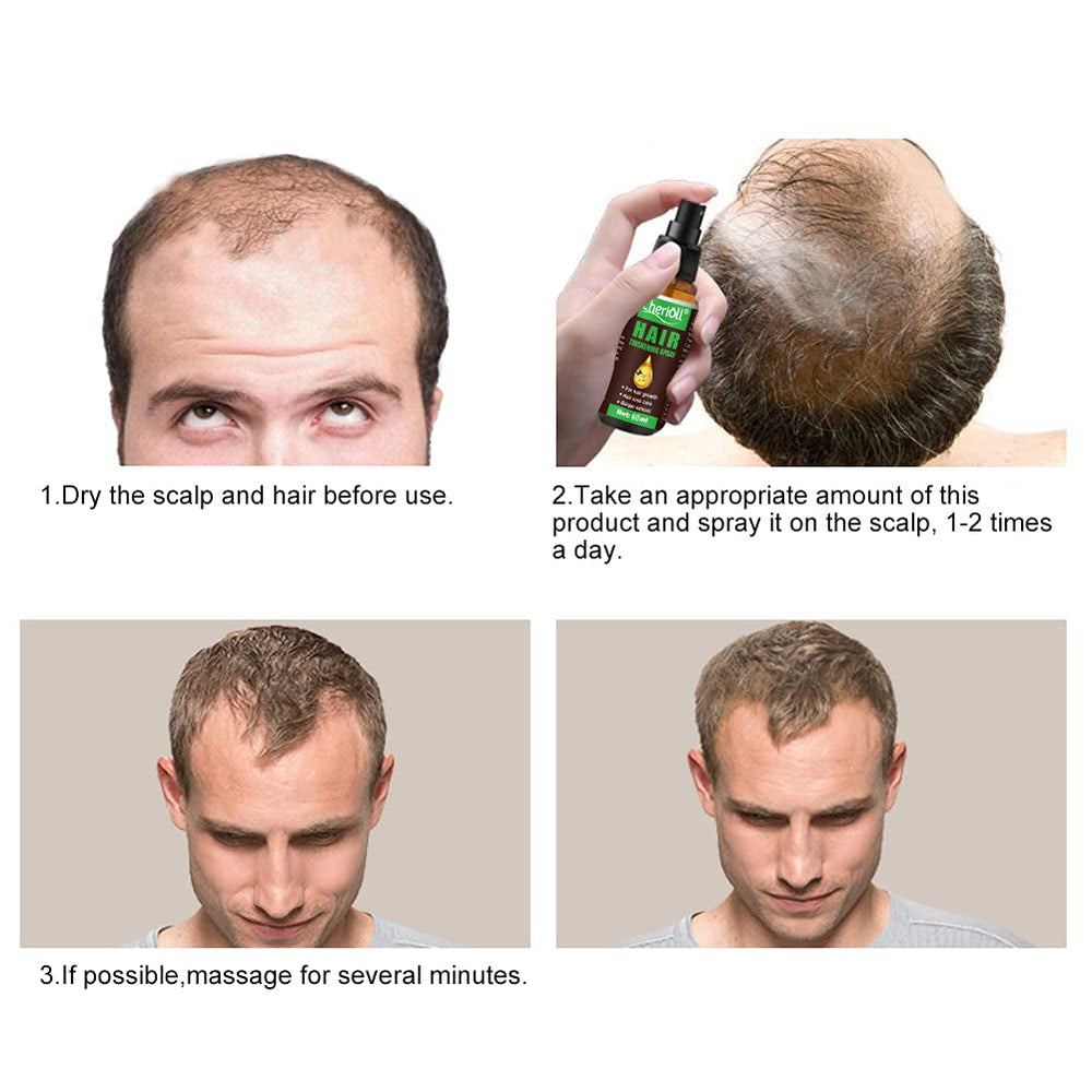 Croissance des cheveux, anti-chute, spray pour la croissance des cheveux, perte de cheveux et traitement des cheveux, pour cheveux clairsemés, favorise une croissance des cheveux plus épaisse, plus complète et plus rapide, 60 ml de soins capillaires Naty Shop