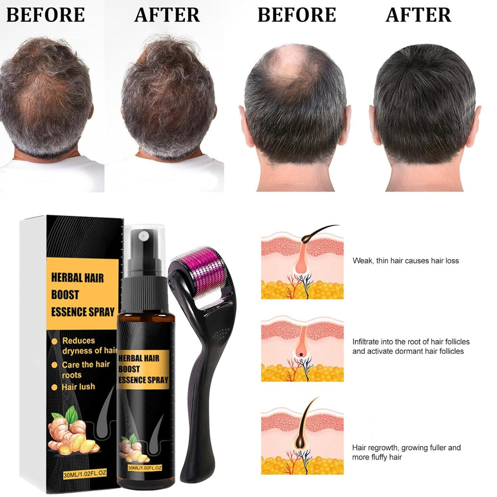Kit de traitement avancé pour la croissance des cheveux 30 ml 2 pièces Spray pour la croissance des cheveux Rouleau de croissance des cheveux et ensemble d'essences Sérum pour la croissance des cheveux Anti-chute Sérum avancé pour la croissance des cheveux Soins capillaires Naty Shop