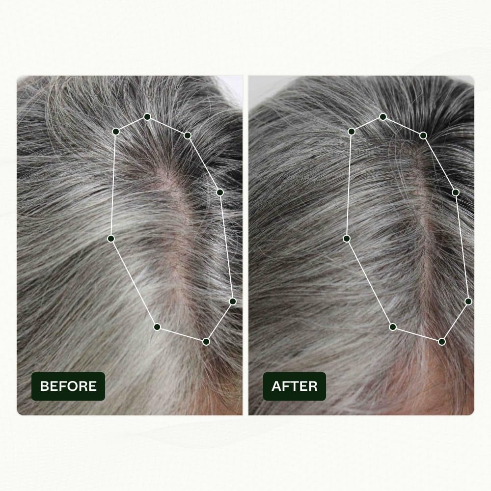 Routine de croissance des cheveux de Norwegian Biolabs pour les femmes avec des résultats cliniquement prouvés en 45 jours | Traitement contre la chute des cheveux (Bio-Pilixin) Naty Shop Soins Capillaires