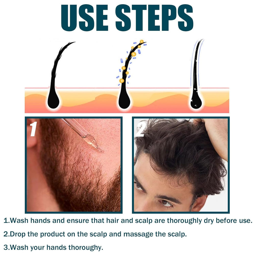 Miioto Sérum de Croissance des Cheveux Hommes Produit de Croissance des Cheveux Sérum de Croissance des Cheveux Soins du Cuir Chevelu Promouvoir des Cheveux Plus Épais Nourrir le Cuir Chevelu Prévenir la Perte de Cheveux 3*60ML Soins des Cheveux Naty Shop