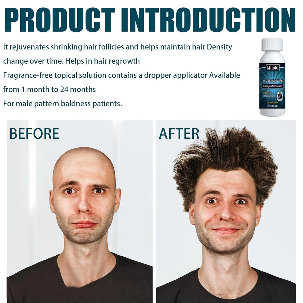 Miioto Sérum de Croissance des Cheveux Hommes Produit de Croissance des Cheveux Sérum de Croissance des Cheveux Soins du Cuir Chevelu Promouvoir des Cheveux Plus Épais Nourrir le Cuir Chevelu Prévenir la Perte de Cheveux 3*60ML Soins des Cheveux Naty Shop