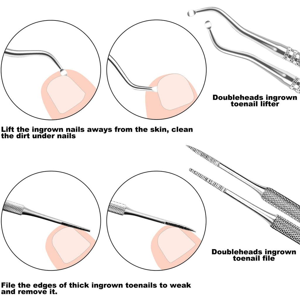 7-Teiliges Set Mit Feilen Und Hebern Für Eingewachsene Zehennägel, Set Aus Edelstahl Zum Entfernen Eingewachsener Zehennägel, Nagelreiniger Für Die Unternagelpflege, Pediküre-Werkzeuge