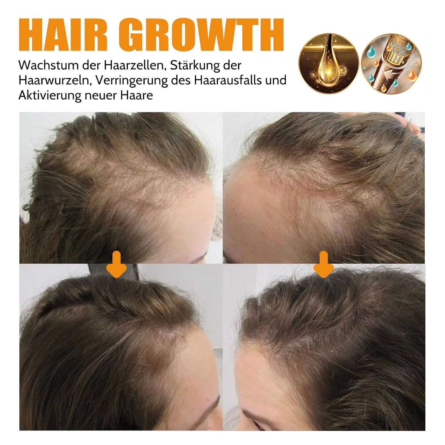 Sérum capillaire à la biotine, 2PCS Spray pour la croissance des cheveux Accélérer la croissance des cheveux Sérum Biotine pour la croissance des cheveux Spray pour la croissance des cheveux, soin capillaire pour cheveux fins et secs, contre la chute des cheveux (M-2pcs) Soins capillaires Naty Shop