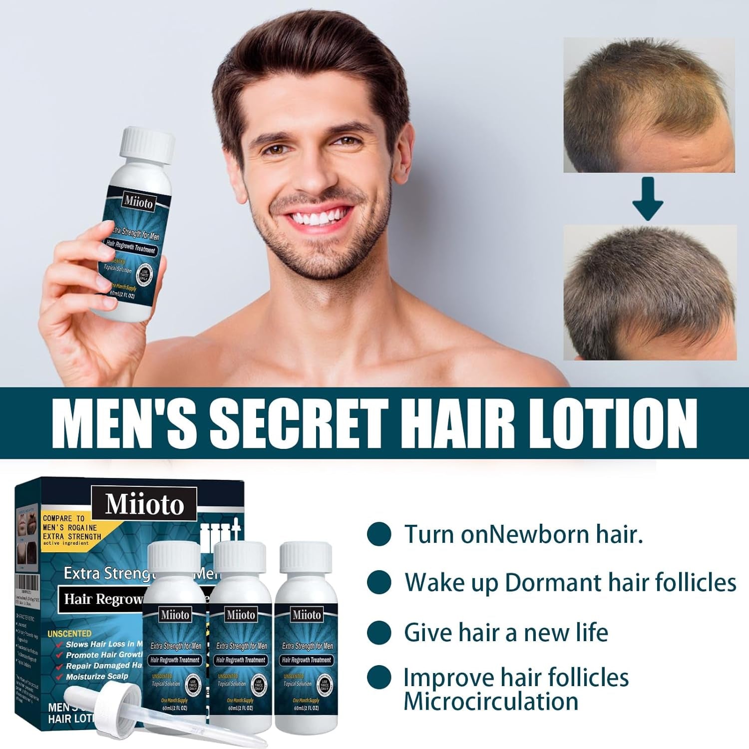 Miioto Sérum de Croissance des Cheveux Hommes Produit de Croissance des Cheveux Sérum de Croissance des Cheveux Soins du Cuir Chevelu Promouvoir des Cheveux Plus Épais Nourrir le Cuir Chevelu Prévenir la Perte de Cheveux 3*60ML Soins des Cheveux Naty Shop