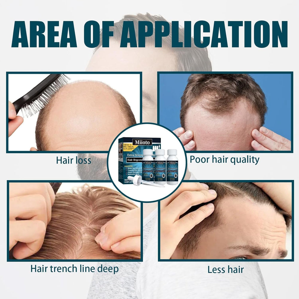 Miioto Sérum de Croissance des Cheveux Hommes Produit de Croissance des Cheveux Sérum de Croissance des Cheveux Soins du Cuir Chevelu Promouvoir des Cheveux Plus Épais Nourrir le Cuir Chevelu Prévenir la Perte de Cheveux 3*60ML Soins des Cheveux Naty Shop